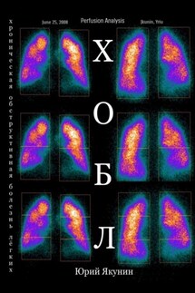 ХОБЛ. Хроническая обструктивная болезнь лёгких