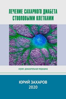 Лечение сахарного диабета стволовыми клетками. Серия: Доказательная медицина