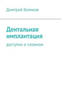 Дентальная имплантация. Доступно о сложном